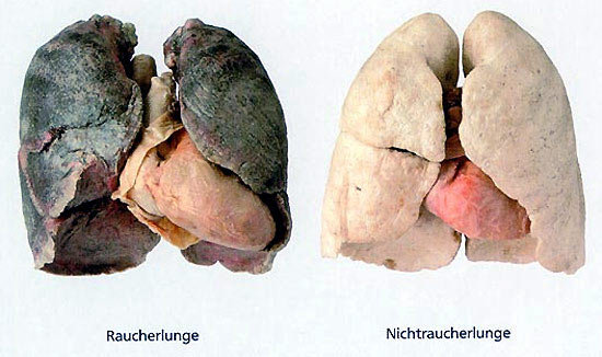 Raucher Lunge & Nichtraucher Lunge
